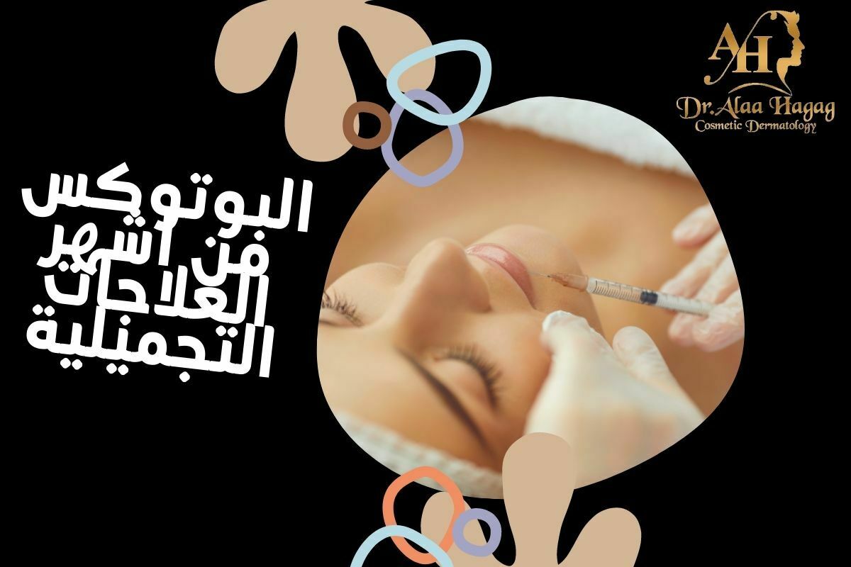 شروط اساسيه للخضوع لإجراء حقن البوتوكس :