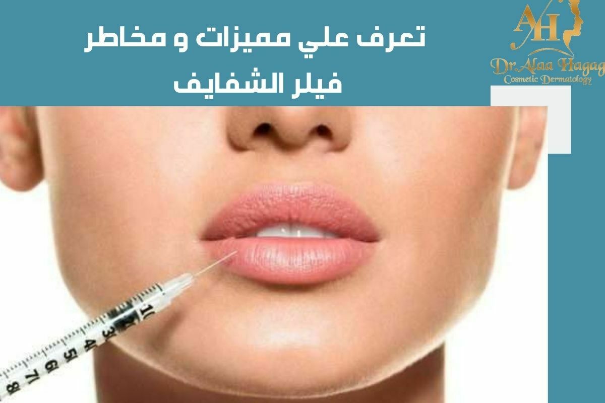 تعرف علي مميزات و مخاطر فيلر الشفايف