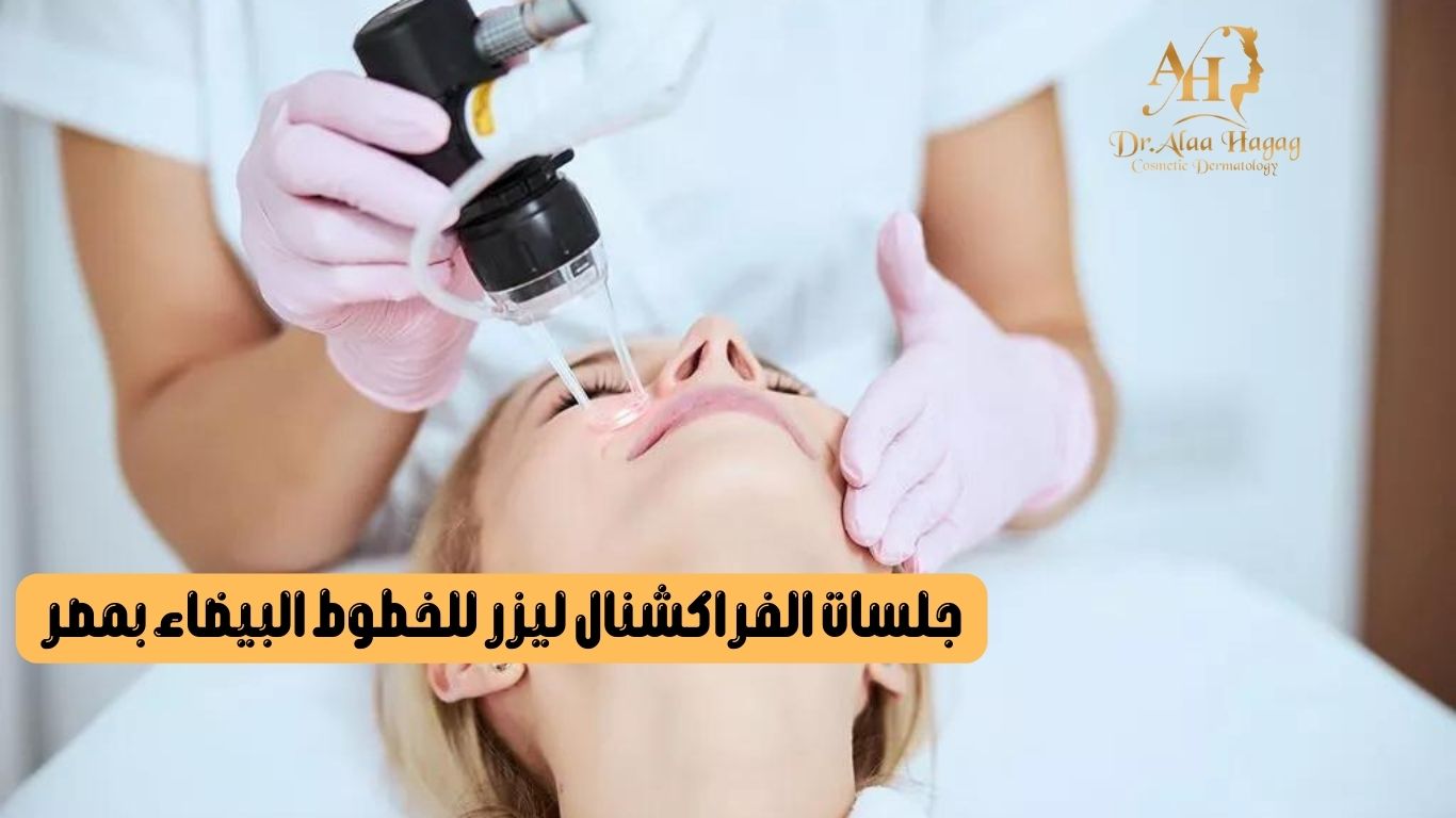 جلسات الفراكشنال ليزر للخطوط البيضاء بمصر
