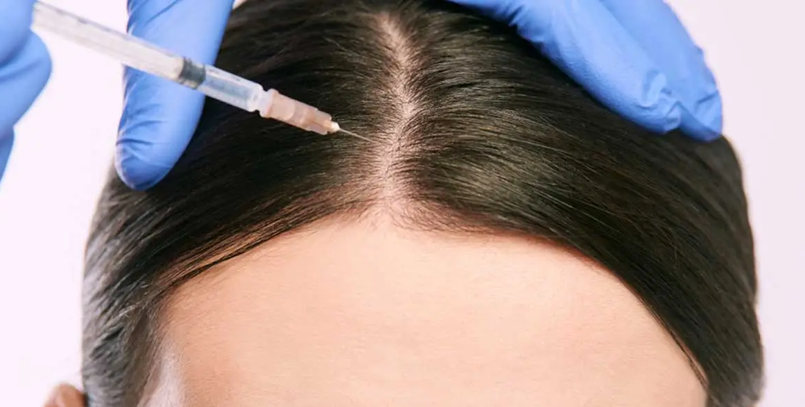 حقن البلازما