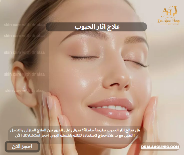 علاج اثار الحبوب