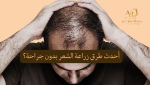 أحدث طرق زراعة الشعر بدون جراحة؟