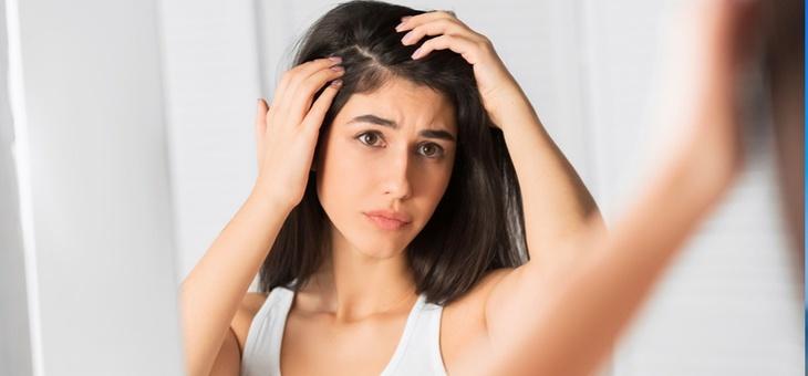 علاج اكزيما الشعر