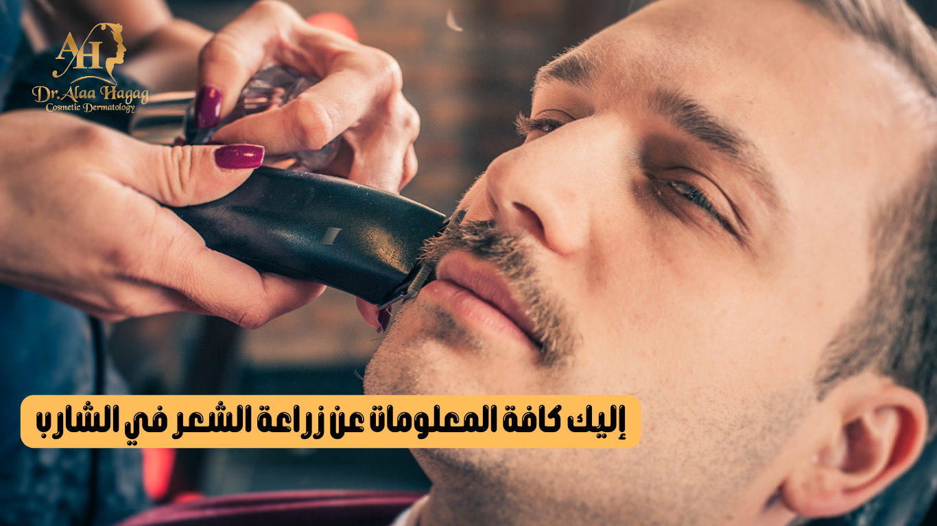 زراعة الشعر في الشارب