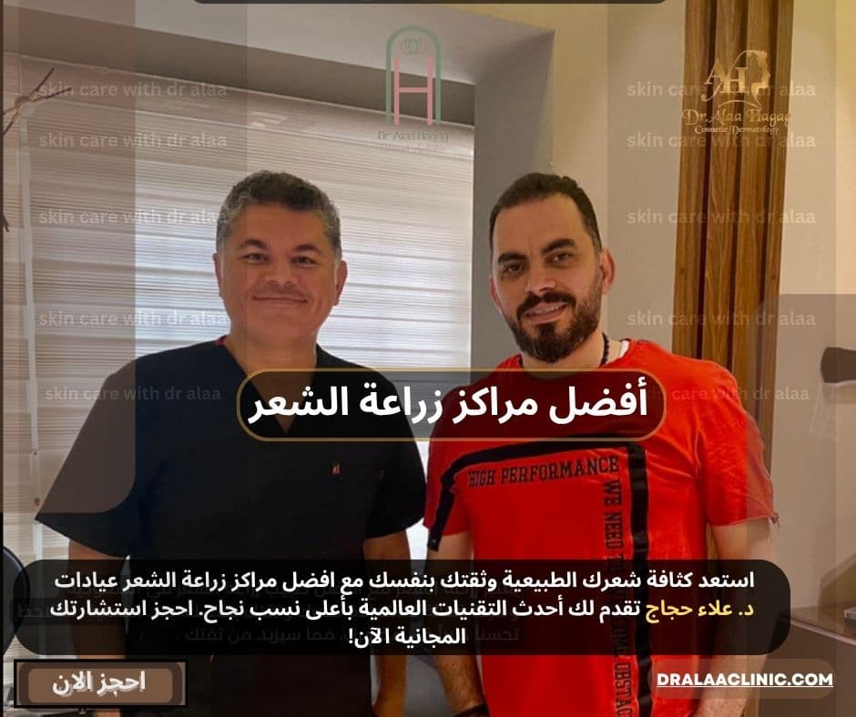 افضل مراكز زراعة الشعر