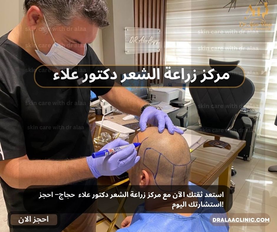 مركز زراعة الشعر دكتور علاء حجاج