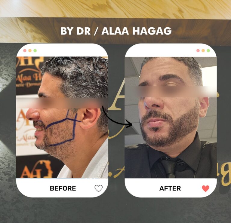 عيادات زراعة الشعر في التجمع