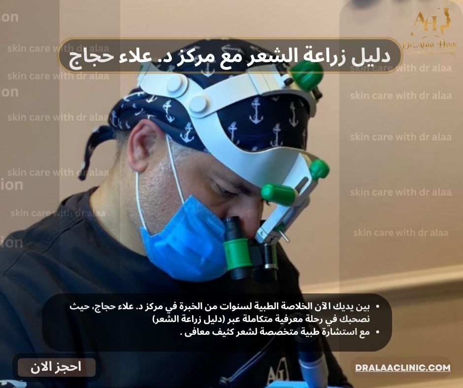 دليل زراعة الشعر مع مركز د. علاء حجاج