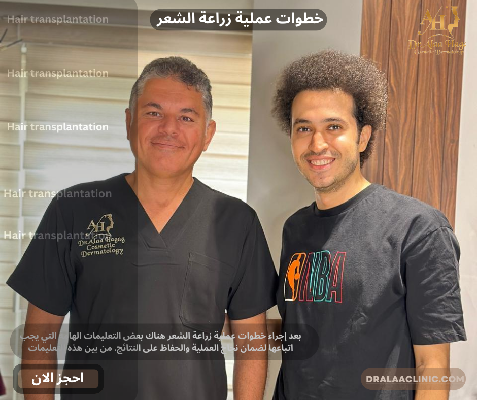 خطوات عملية زراعة الشعر