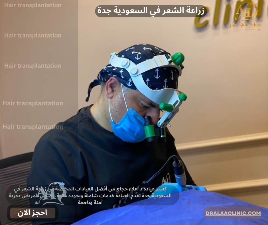 زراعة الشعر في السعودية جدة