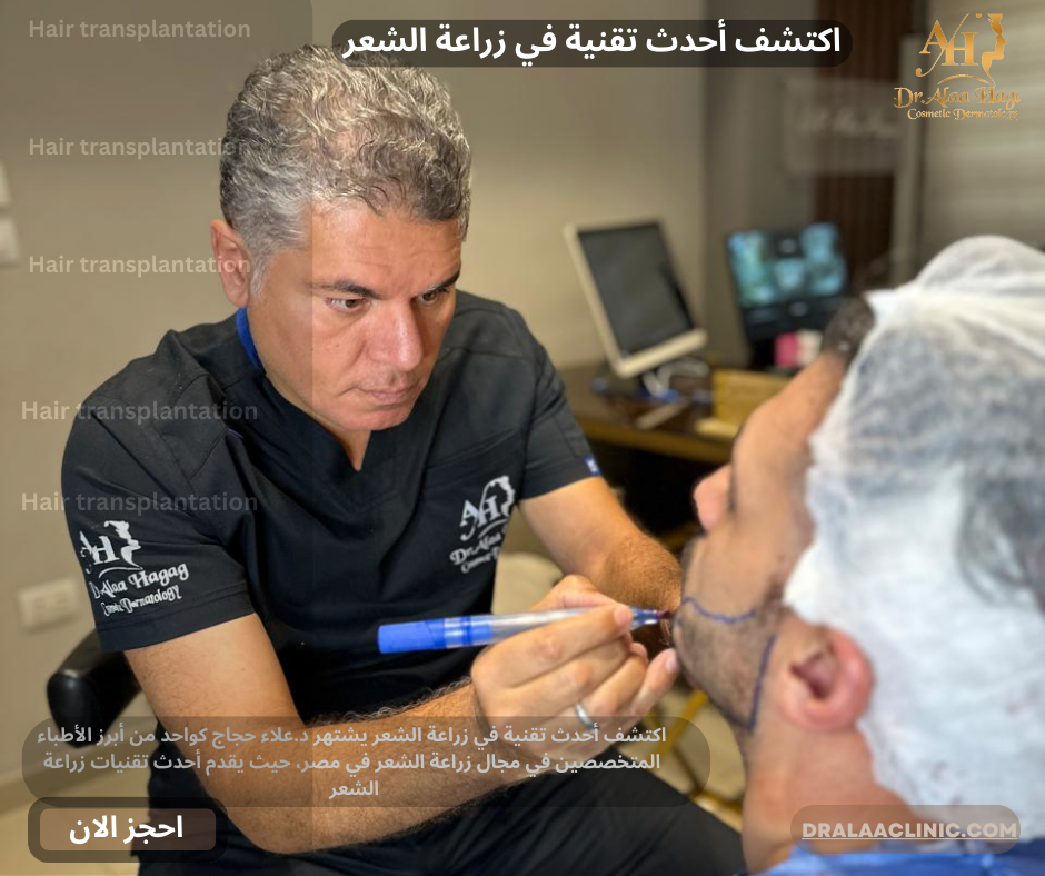 اكتشف أحدث تقنية في زراعة الشعر