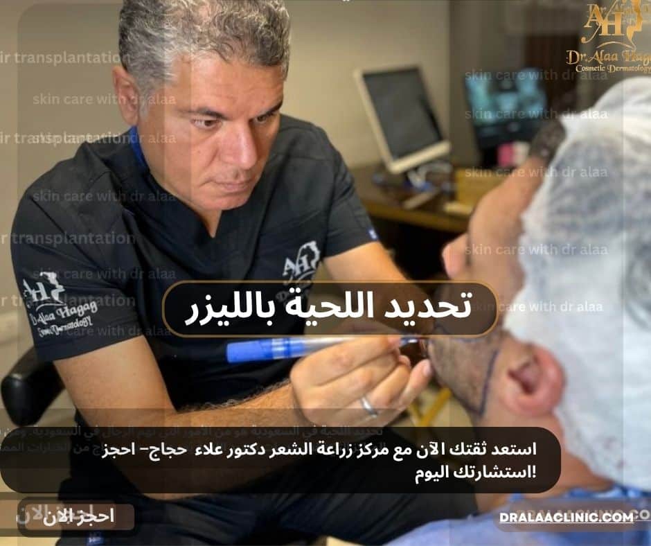 تحديد اللحية بالليزر