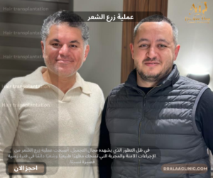 عملية زرع الشعر