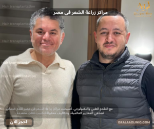 مراكز زراعة الشعر فى مصر