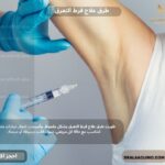 طرق علاج فرط التعرق​
