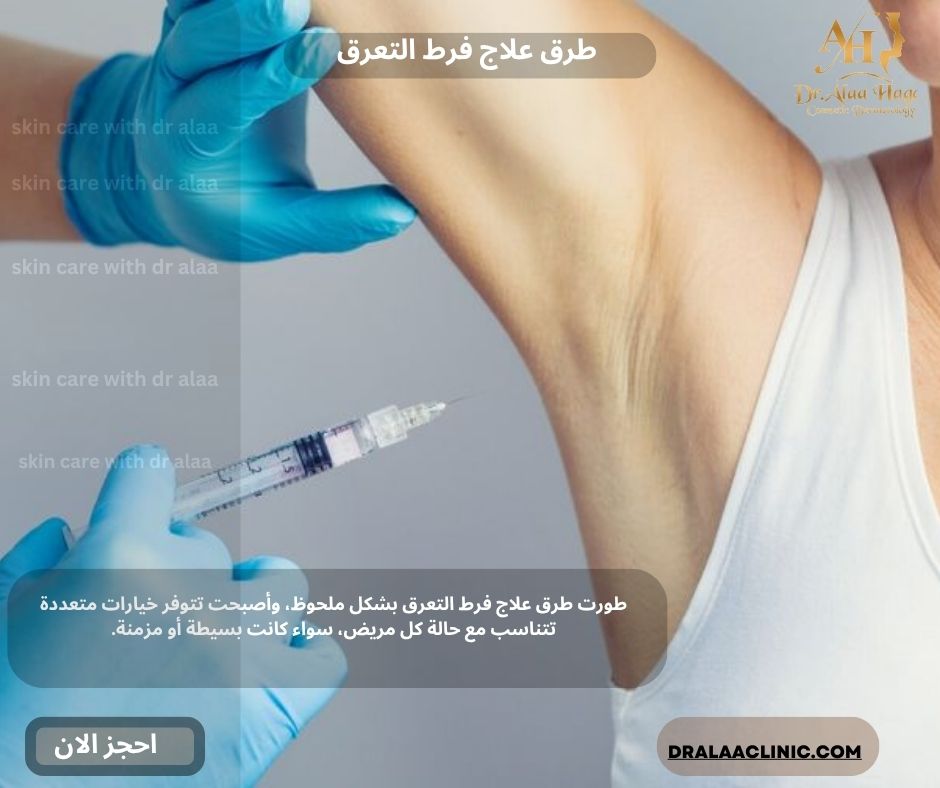 طرق علاج فرط التعرق​