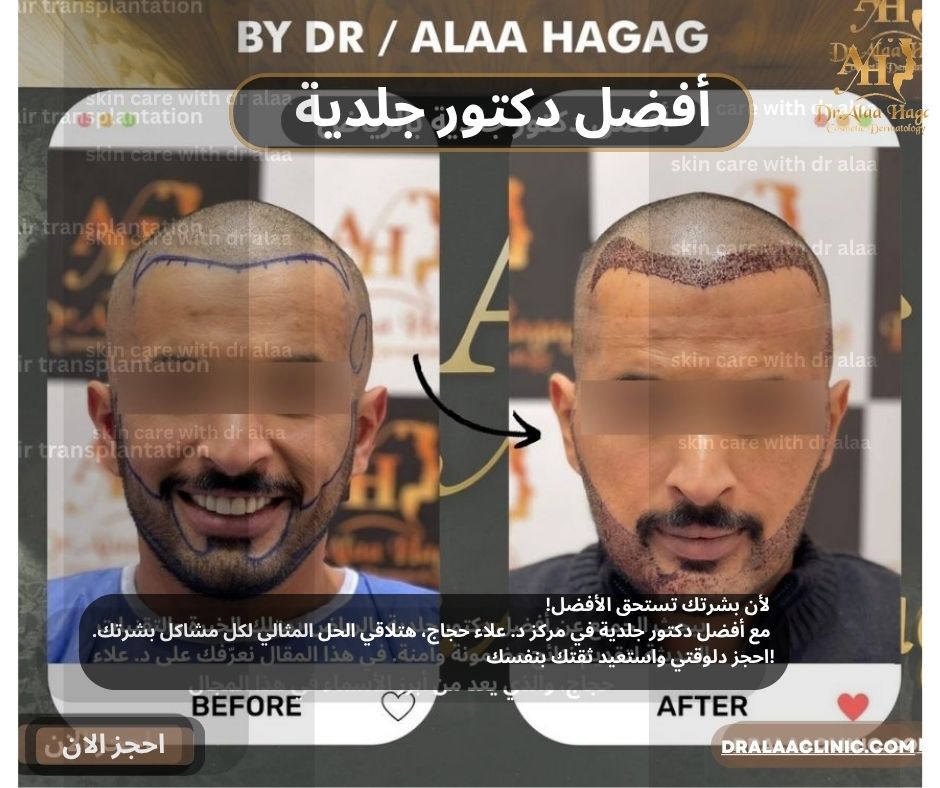 أفضل دكتور جلدية في الوطن العربي