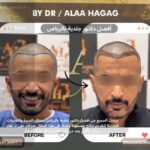 أفضل دكتور جلدية بالرياض