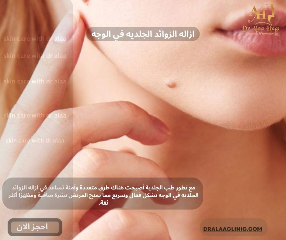 ازاله الزوائد الجلديه في الوجه