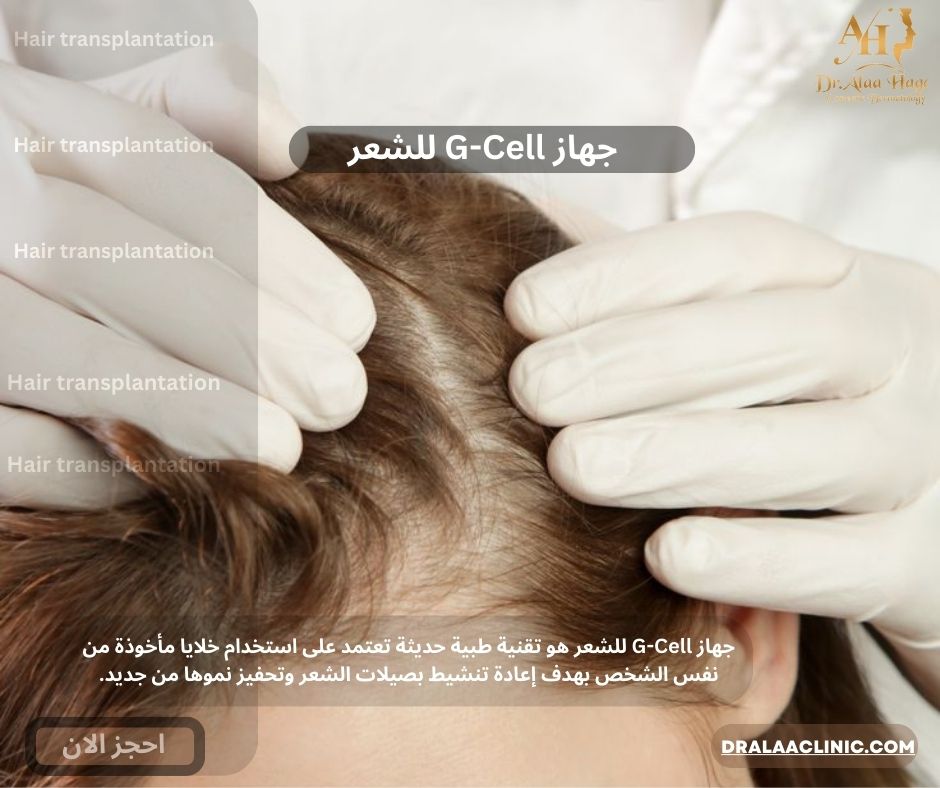 جهاز G-Cell للشعر