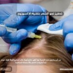 تحفيز نمو الشعر بتقنيه الإكسوزوم