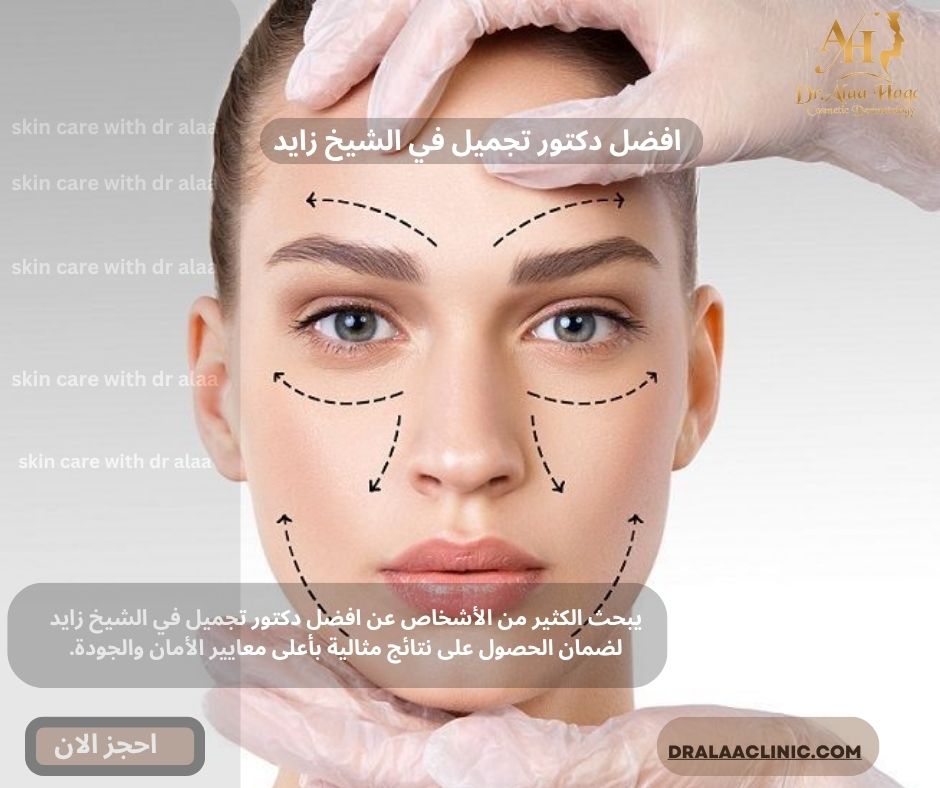 افضل دكتور تجميل في الشيخ زايد