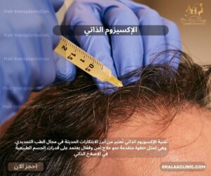 الإكسوزوم الذاتي