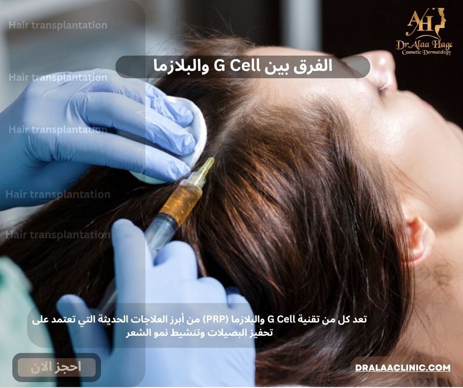 الفرق بين G Cell والبلازما