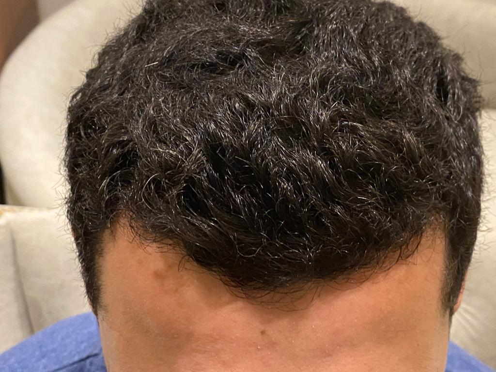 الفرق بين G Cell والبلازما