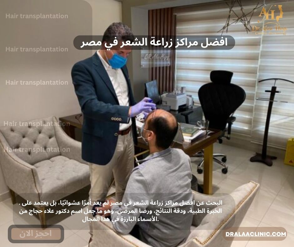 افضل مراكز زراعة الشعر في مصر