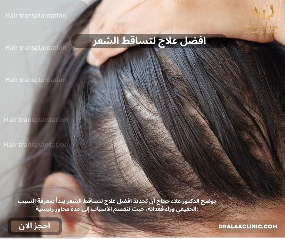افضل علاج لتساقط الشعر