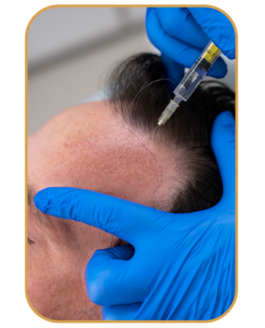 تقنية C Cell لعلاج تساقط الشعر