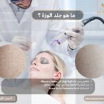 ما هو جلد الوزة