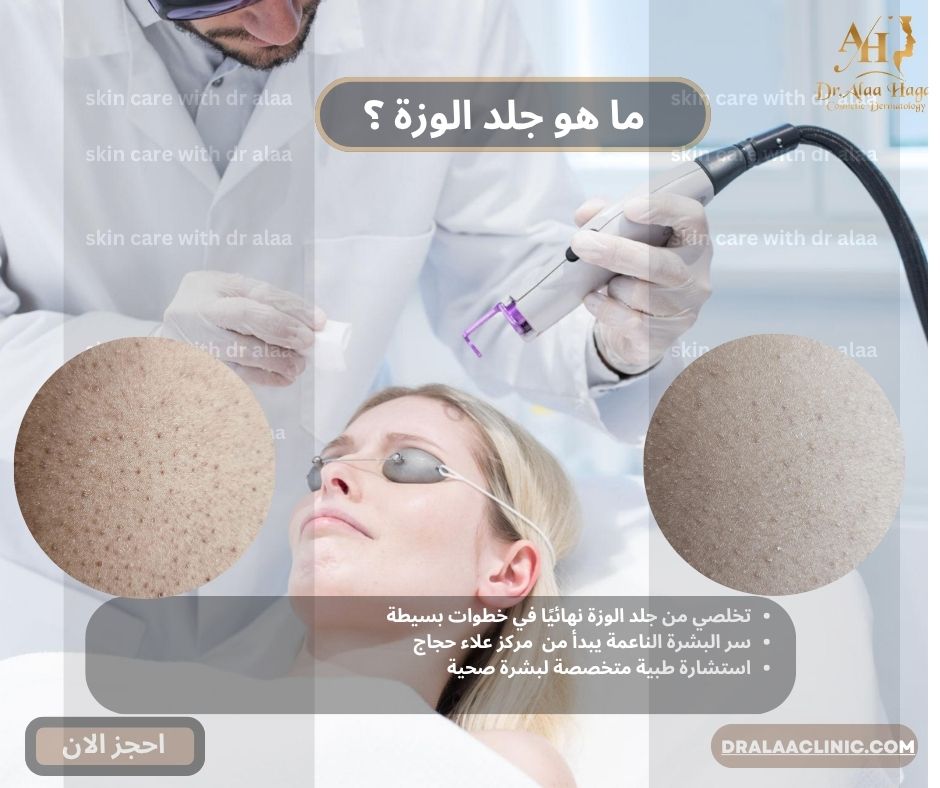 ما هو جلد الوزة