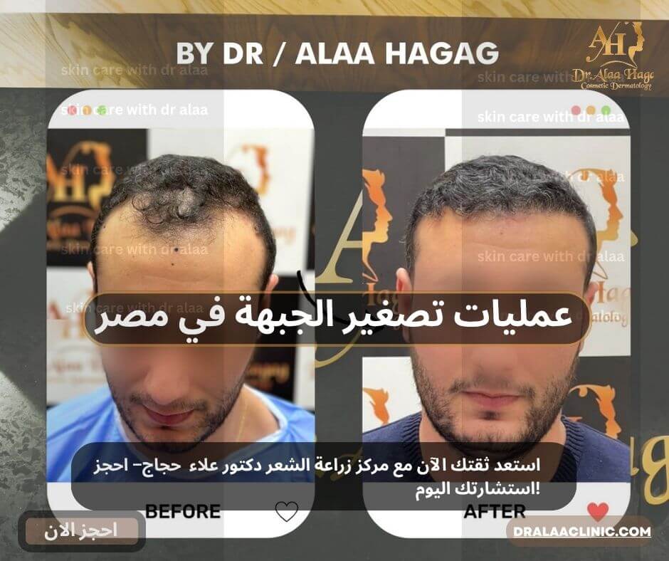 عمليات تصغير الجبهة في مصر