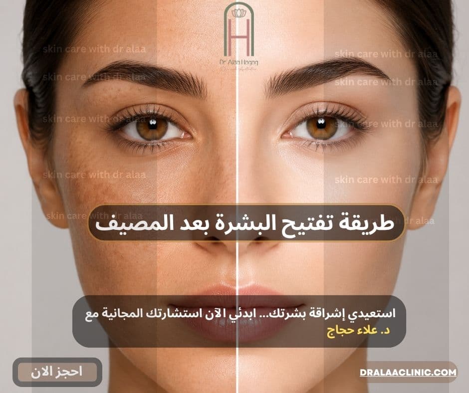 طريقة تفتيح البشرة بعد المصيف