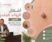 أشكال الزوائد الجلدية بالصور 2026: الدليل الطبي الكامل لتمييز الآمن من الخطير مع د. علاء حجاج