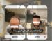 زراعة الشعر للرجال قبل وبعد