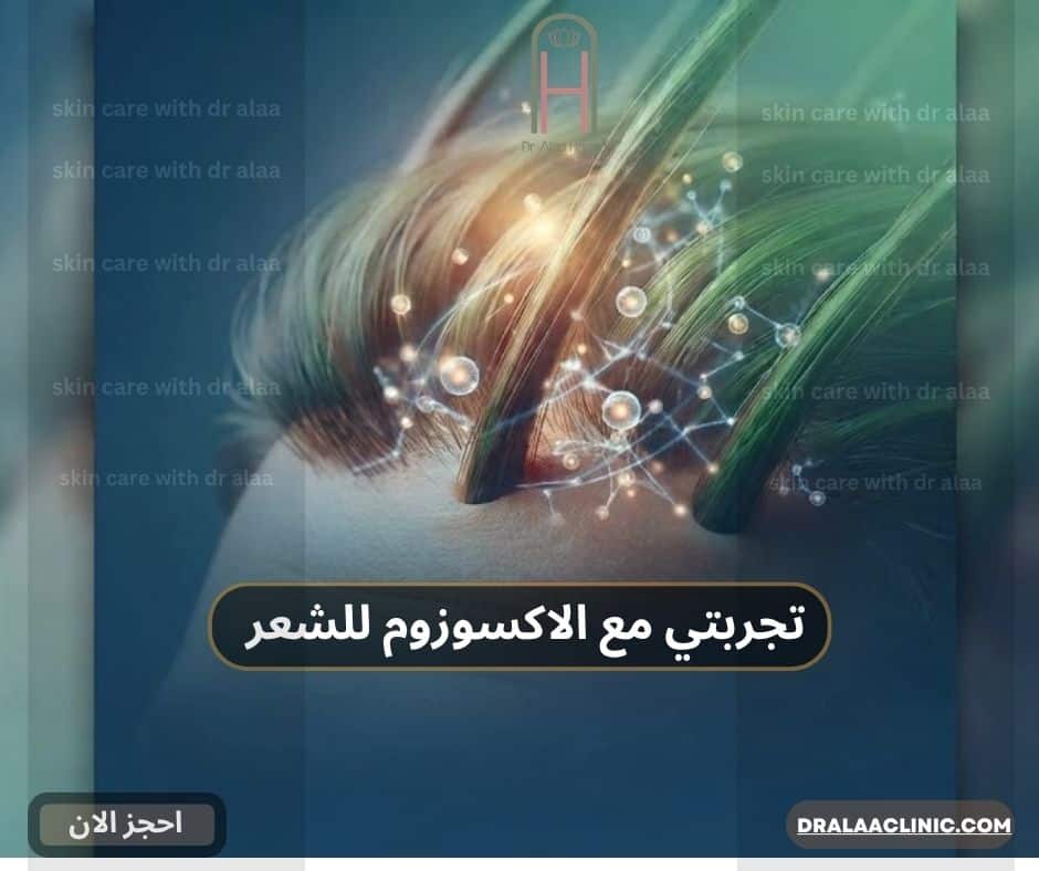 تجربتي مع الاكسوزوم للشعر