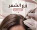 زرع الشعر للنساء