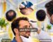 دكتور زراعة شعر