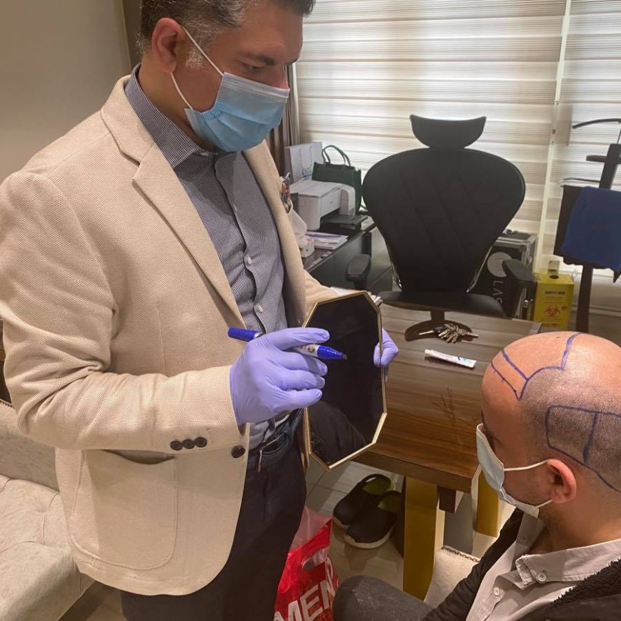 افضل دكتور زراعة الشعر في مصر